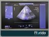 SIEMENS/ACUSON 2016 4V1C VECTOR ARRAY ULTRASOUND TRANSDUCER PROBE REF: 11286579 TESTED 30 DAYS WARRANTY Ultrasound Transducer