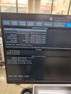 GE LOGIQ P8 Ultrasound - Cardiac - Vascular