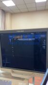 TOSHIBA PLT-704AT Ultrasound Transducer