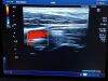 TOSHIBA PLU-1204BT Ultrasound Transducer