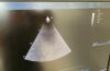GE HEALTHCARE M5Sc-D Ultrasound Transducer