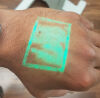CHRISTIE Vision Vein Viewer