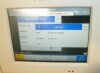 PHILIPS FM20 Fetal Monitor