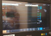 PHILIPS Intellivue G7M G7 Anesthesia Monitor