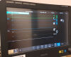 PHILIPS Intellivue G7M G7 Anesthesia Monitor