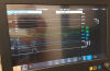 PHILIPS Intellivue G7M G7 Anesthesia Monitor