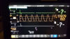 PHILIPS MX450 ICU/CCU