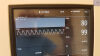 PHILIPS MP5 Anesthesia Monitor