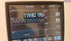 PHILIPS MP5 Anesthesia Monitor