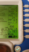 ZOLL z vent Transport Ventilator