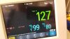 PHILIPS Avalon FM30 Fetal Monitor