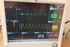 GE Carescape B650 Anesthesia Monitor