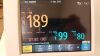 PHILIPS Avalon FM30 Fetal Monitor