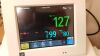 PHILIPS Avalon FM30 Fetal Monitor
