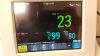 PHILIPS Avalon FM30 Fetal Monitor