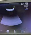 GE HEALTHCARE Voluson E10