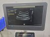 PHILIPS AFFINITI 70G ULTRASOUND MACHINE W/ 3 PROBES 2018