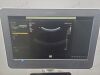 PHILIPS AFFINITI 70G ULTRASOUND MACHINE W/ 3 PROBES 2018