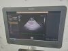 PHILIPS AFFINITI 70G ULTRASOUND MACHINE W/ 4 PROBES 2016