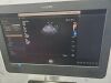 PHILIPS AFFINITI 70G ULTRASOUND MACHINE W/ 4 PROBES 2016