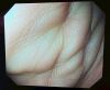 OLYMPUS GIF-H290 Gastroscope