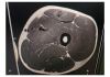 PHILIPS Achieva DStream 3.0T (32Ch) MRI Scanner