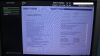 GE Voluson S6 Ultrasound - OB / GYN