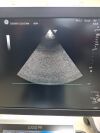 GE 3Sc-RS Ultrasound Transducer