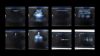 GE LOGIQ P7 Ultrasound