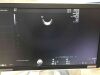GE Voluson S10 Ultrasound