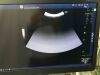 GE LOGIQ S8 FS Ultrasound