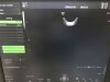 FUJI Voluson P8 Ultrasound