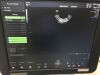 FUJI Voluson P8 Ultrasound