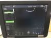 FUJI Voluson P8 Ultrasound