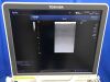 TOSHIBA Aplio400 Ultrasound