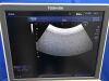 TOSHIBA Aplio400 Ultrasound