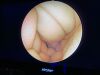 STRYKER 1688 AIM 4K Platform 1688 4K Camera system