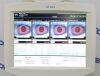 ZEISS Carl  Atlas 9000 Corneal Topographer w/ Windows 7 - 204303 Topographer