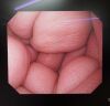 OLYMPUS GIF-H260 Endoscope