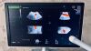 GE Voluson E8 Ultrasound - OB / GYN