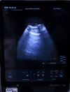 BK MEDICAL 8823 Ultrasound Transducer