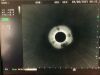 OLYMPUS GF-UE160-AL5 Gastroscope