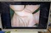 PENTAX EG-3870TK Gastroscope