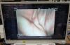 PENTAX EC-3831LK Colonoscope