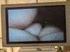 OLYMPUS CYF-VH Cystoscope