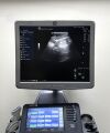 GE HEALTHCARE Logiq S8 Ultrasound System