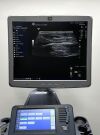 GE HEALTHCARE Logiq S8 Ultrasound System