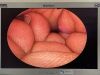 OLYMPUS WA20017A Hysteroscope
