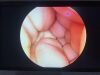 CONMED IM8000 Camera Console  Urology Camera Head IM8123  Tested