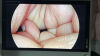 STRYKER 1288-210-105 Arthroscopic Video System